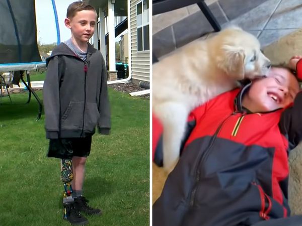 Heartwarming: Boy with prosthetic legs finds best friend in dog born without paw
