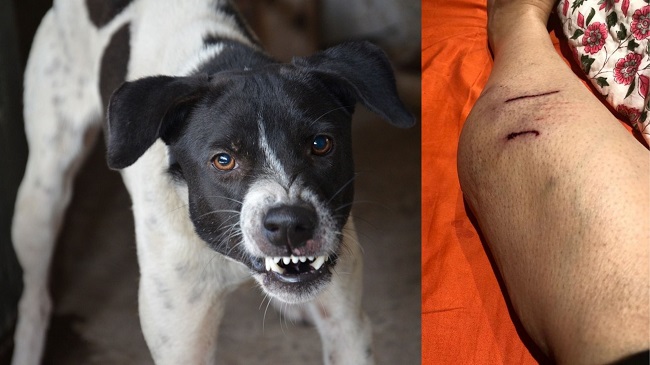 8 Dogs Attack and Bite A Dog Lover In Chandigarh
